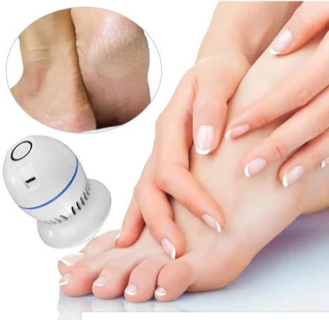 Removedor de Callos y Grietas Beauty Feet